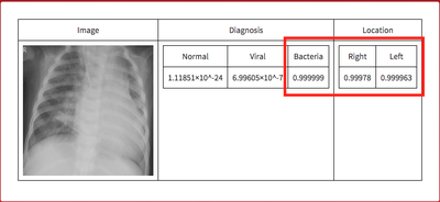 Using Machine Learning to Diagnose Pneumonia from Chest X-Rays