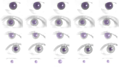 Track and Analyze Pupil Dilation after Exposure to Illumination