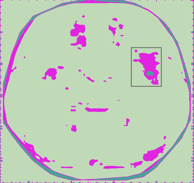 Deconstructing GPT-2 to Relate LLM Activity to fMRI Activation Voxels