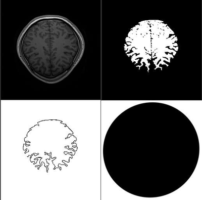 Creating Categorizations of Brains